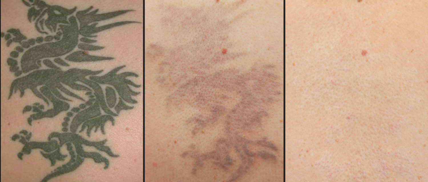 Forever Young MediSpa